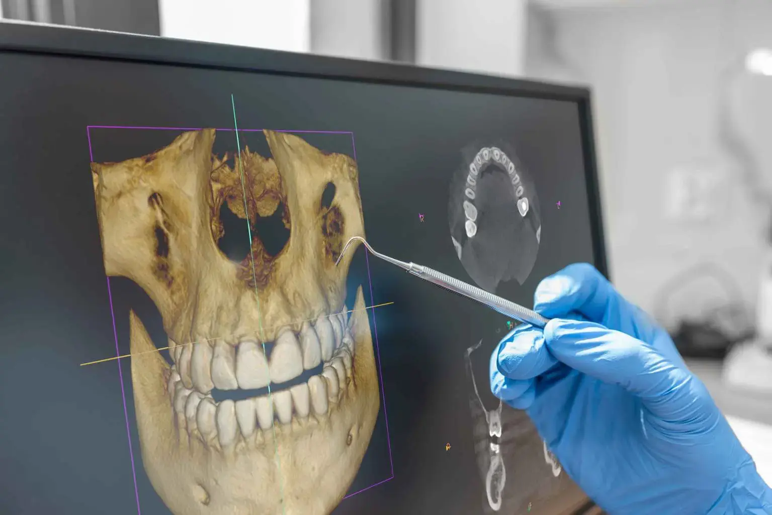 Professional dentist analyzing dental X-ray images at Yayla Dental Akademi